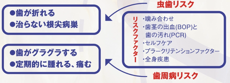 歯の寿命診断とは？