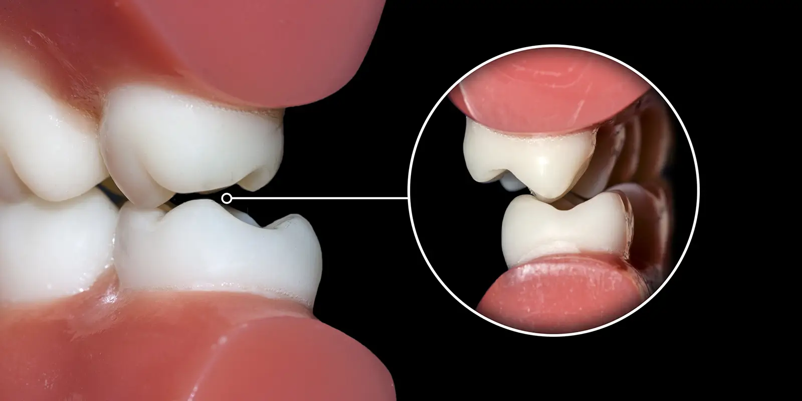 噛み合わせ外来とは