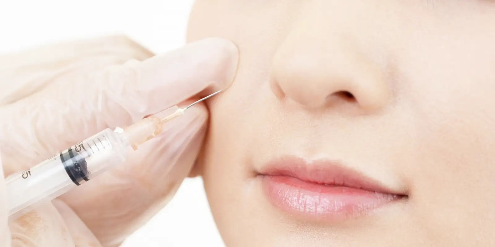 ボトックス治療とは