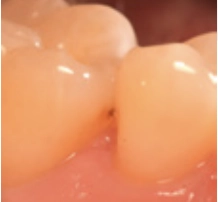 C1