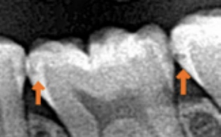 C1