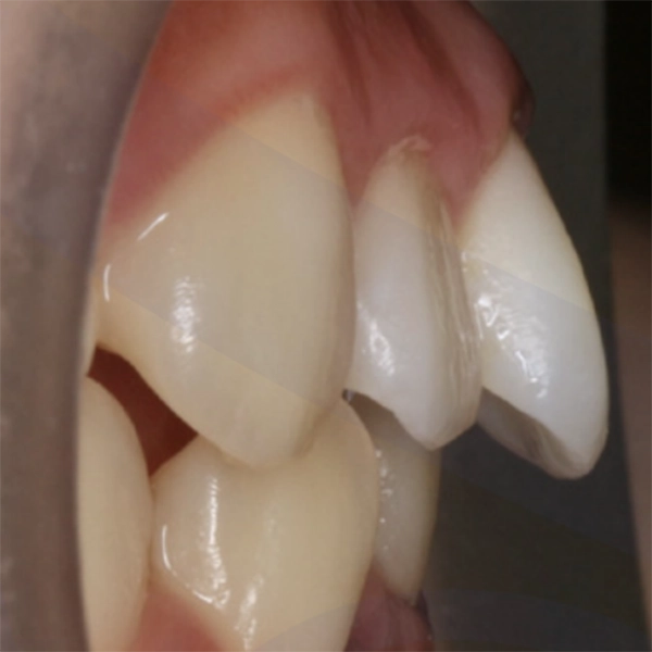 Before