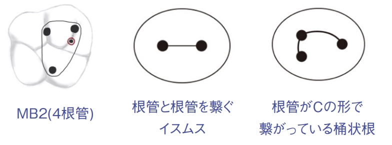 歯の構造