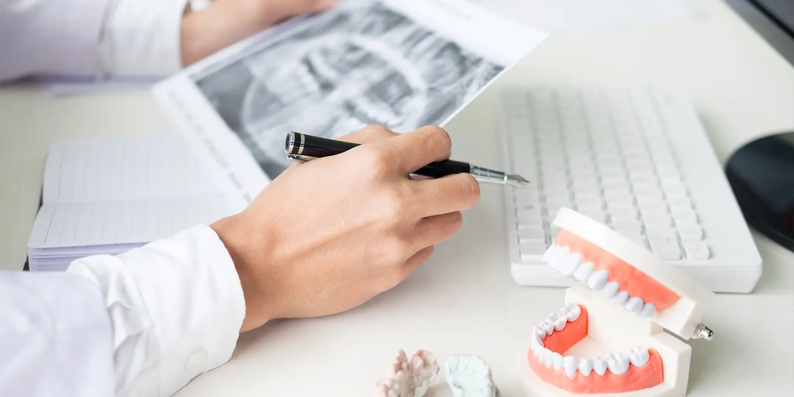 交通事故で起こりやすい口腔外傷の種類