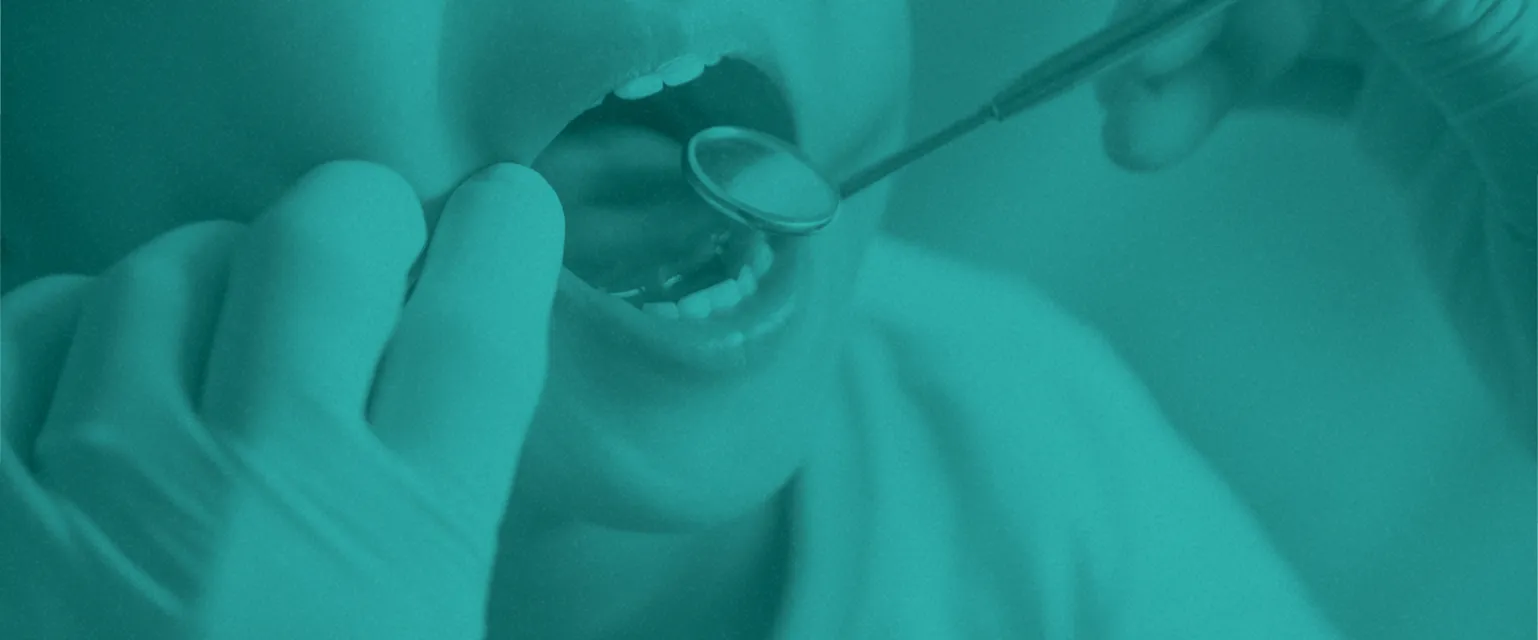 お子さまの矯正治療