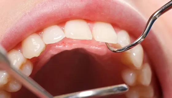 メインテナンス