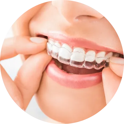 マウスピース矯正(インビザライン)