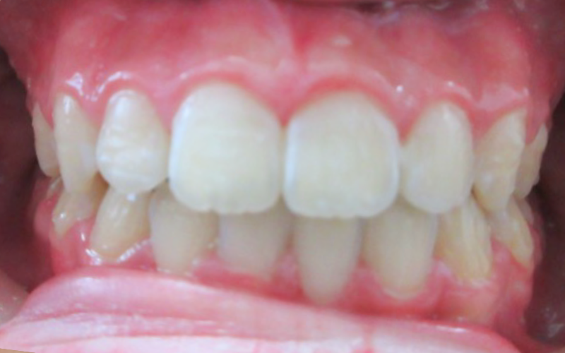 After