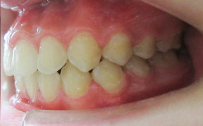 After