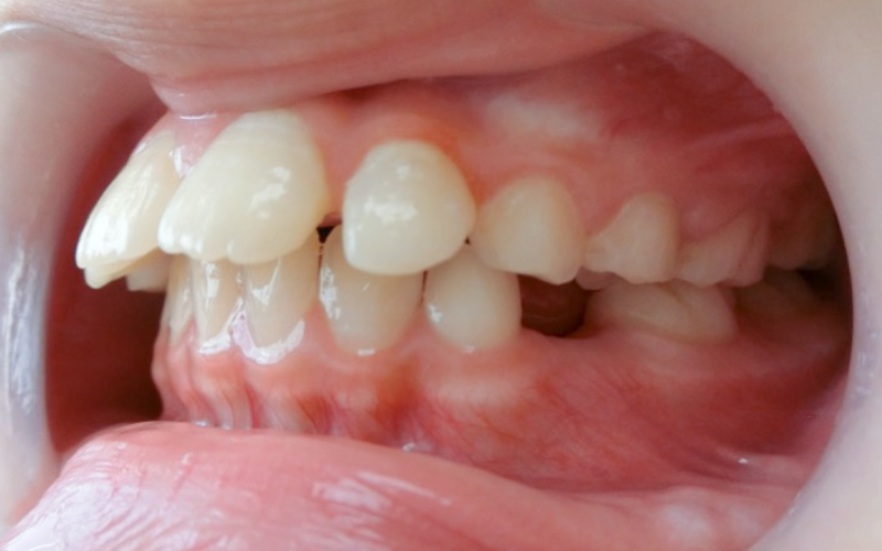 Before