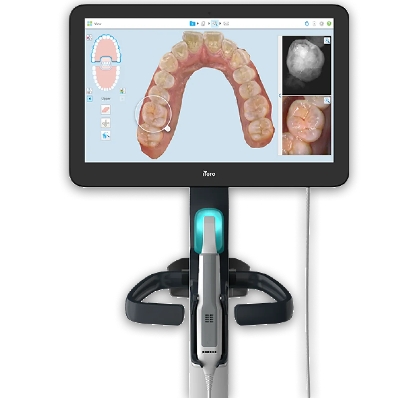 3Dシミュレーションで治療後のイメージを確認