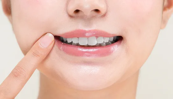 奥歯でしっかり噛んで正面から上下の前歯が写るように撮影