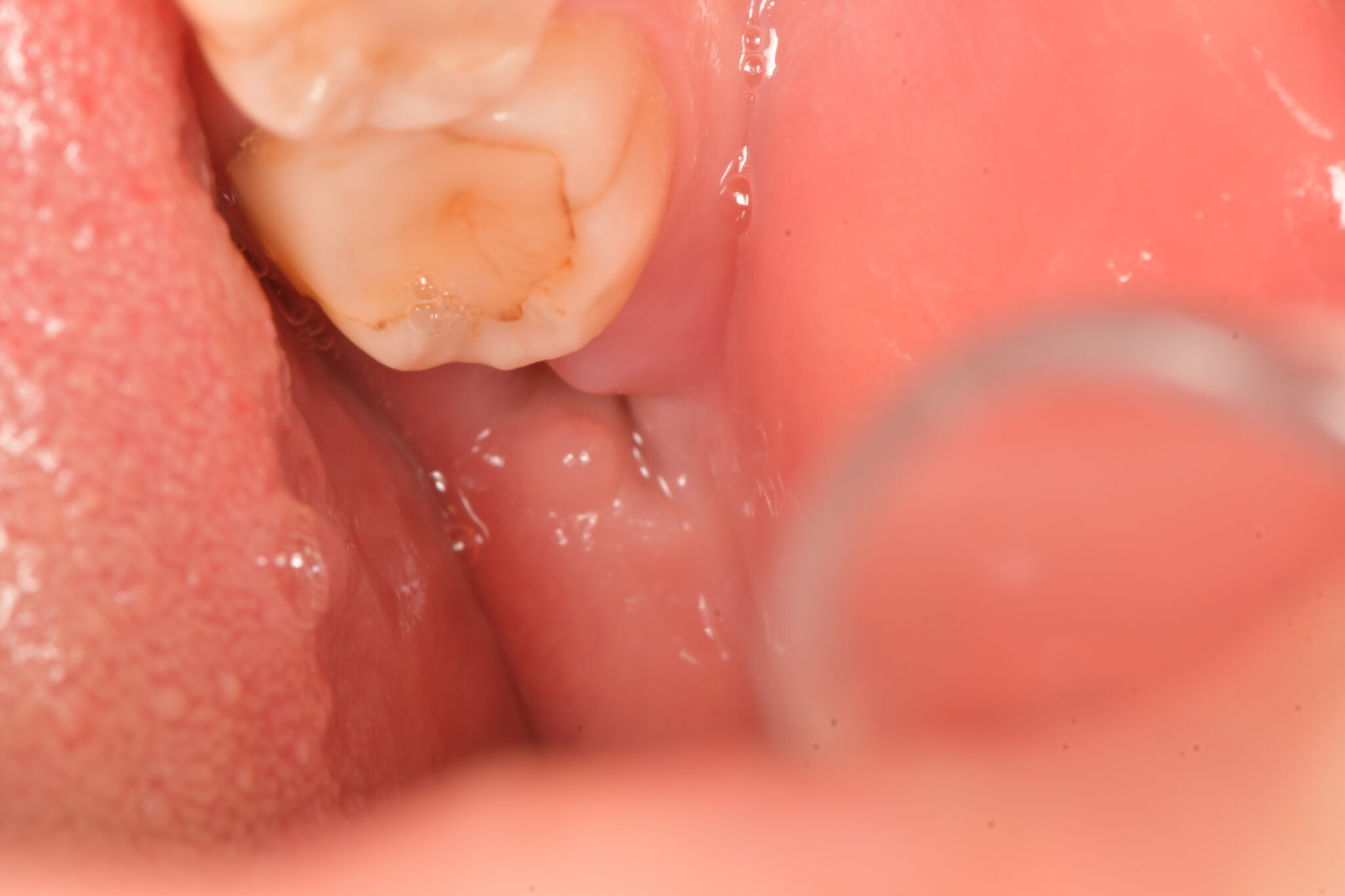 治癒を早める方法