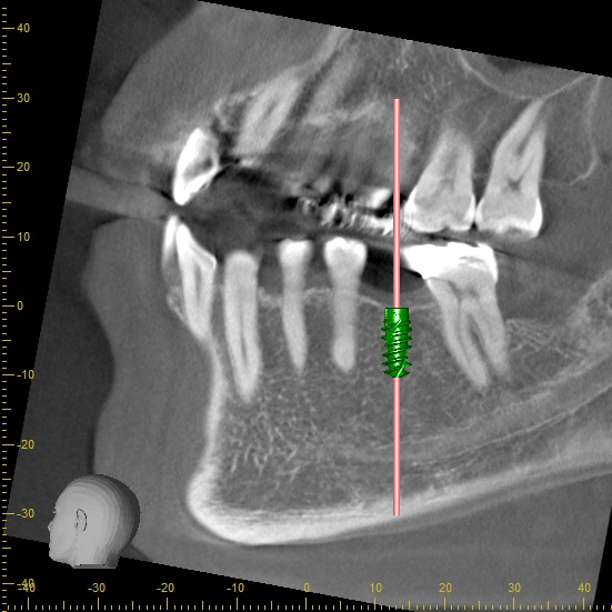 シミュレーション
