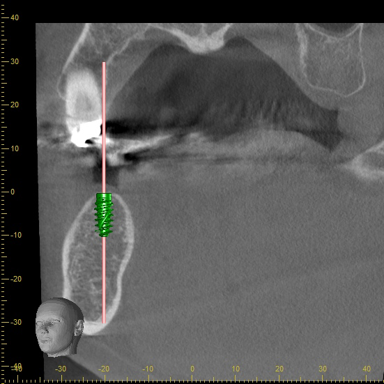 シミュレーション