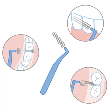 歯間ブラシについて