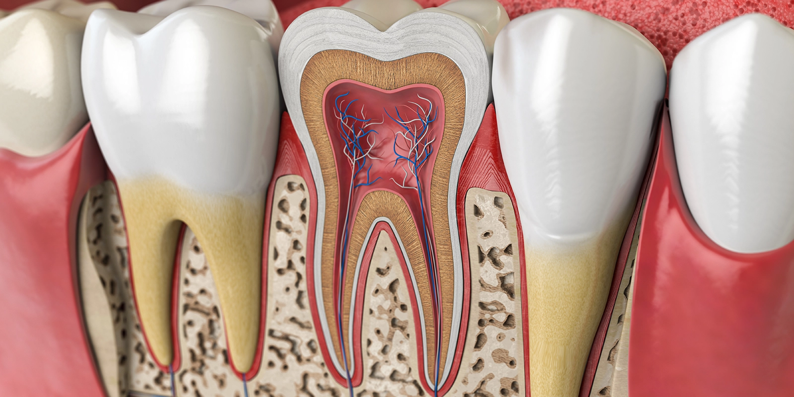 根管治療が必要になる理由と治療の目的
