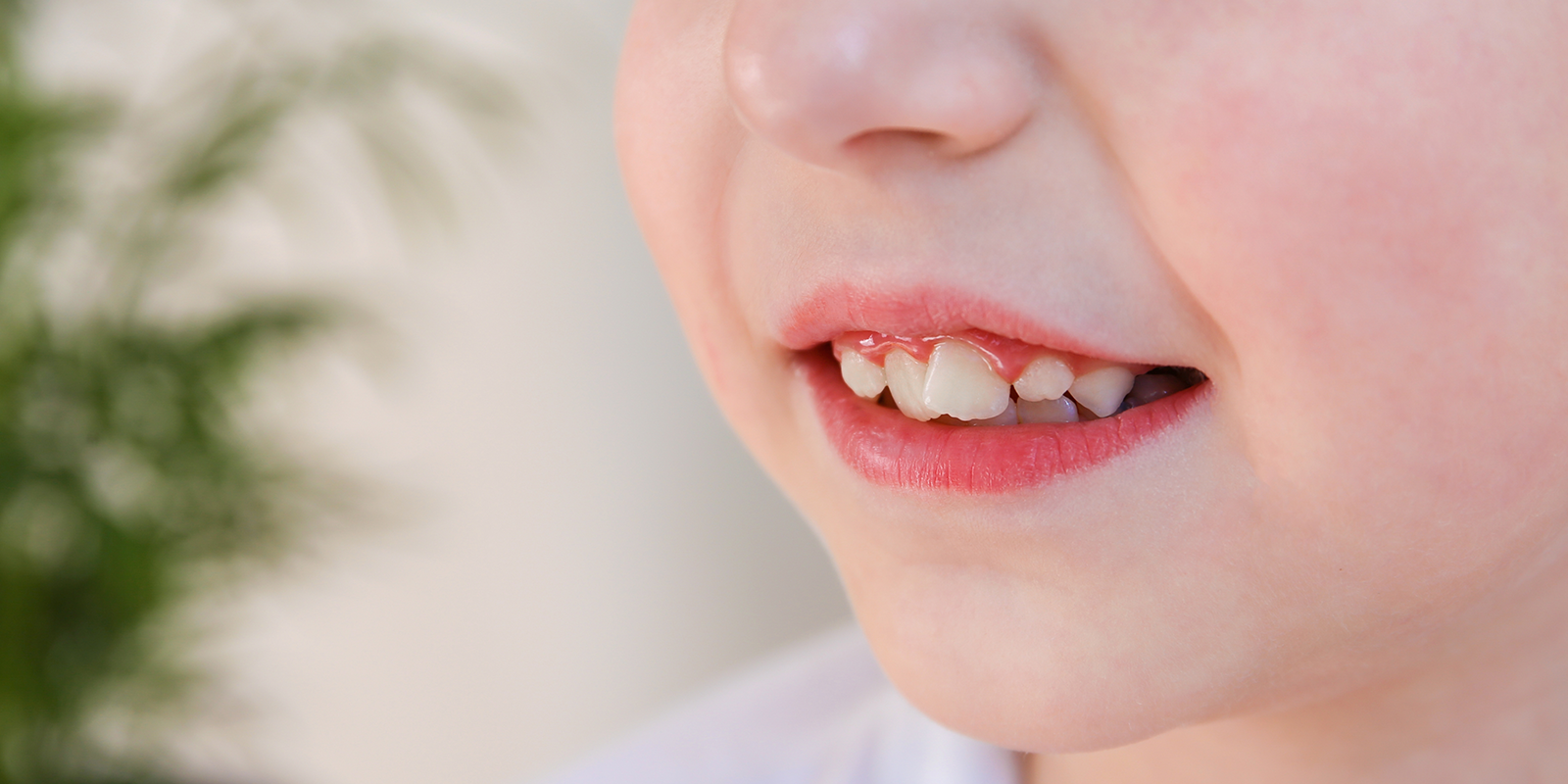 口腔習癖が歯並びと顎の成長に与える影響