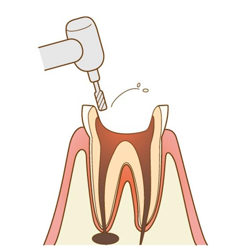 治療法について