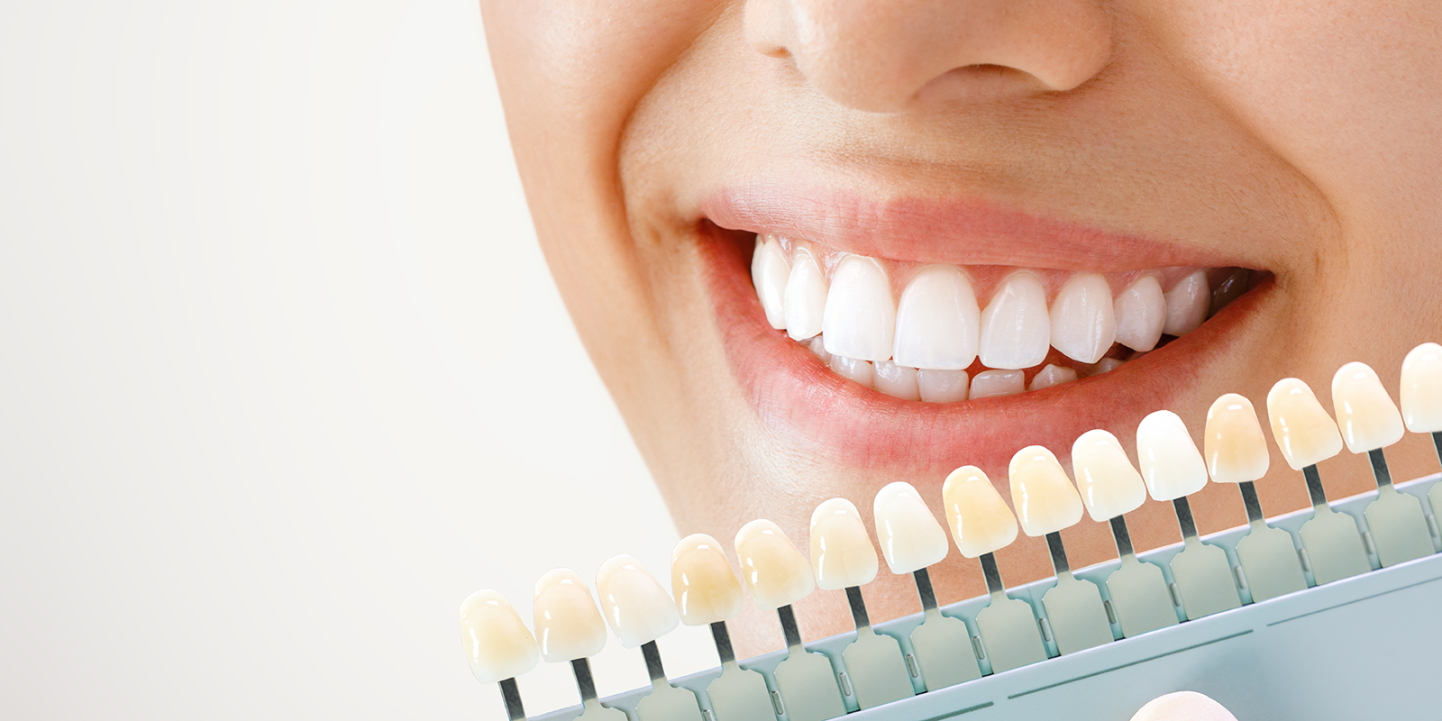 ホワイトニングのメカニズムと歯が変色する原因