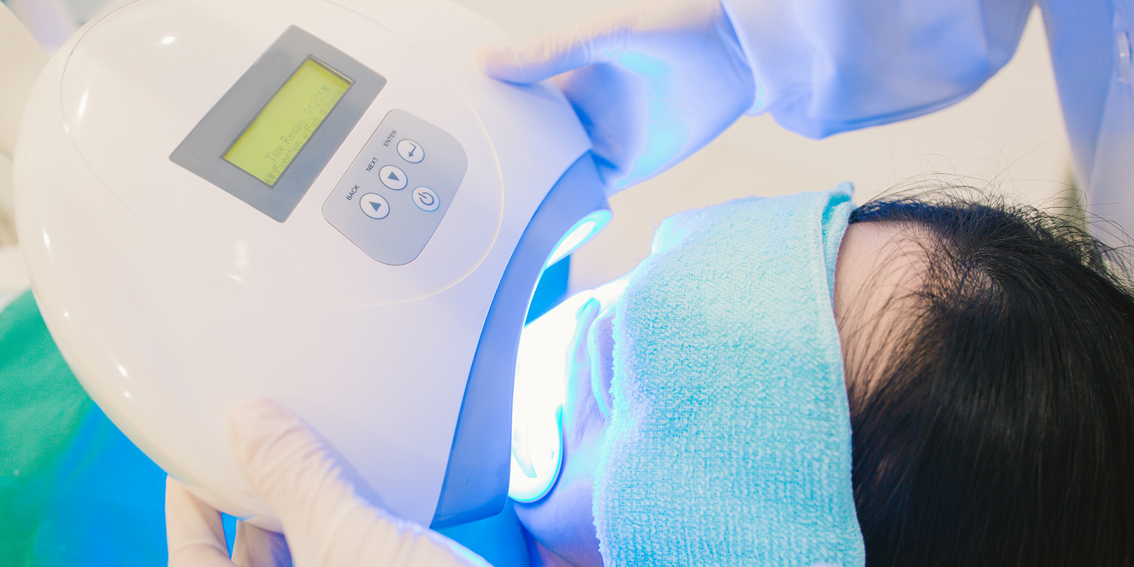 ホワイトニングの種類と特徴