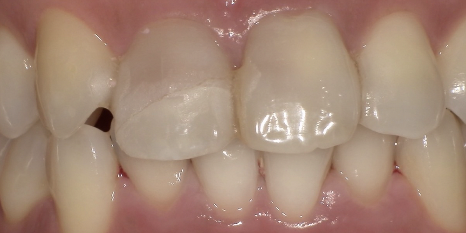 術前・術後の比較