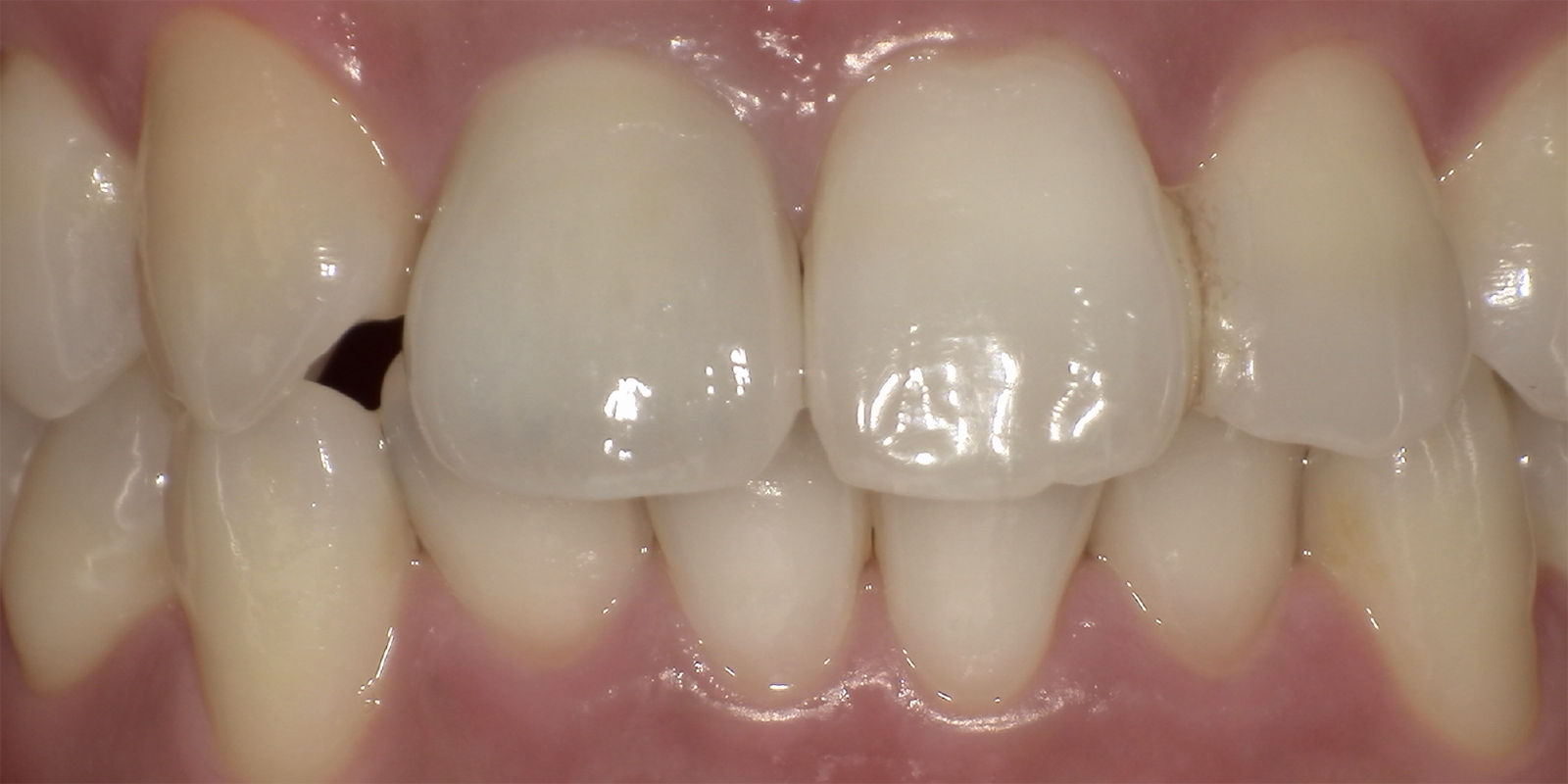 術前・術後の比較