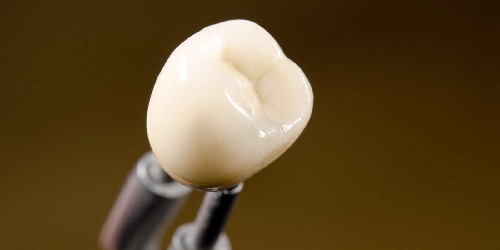 オールセラミッククラウン