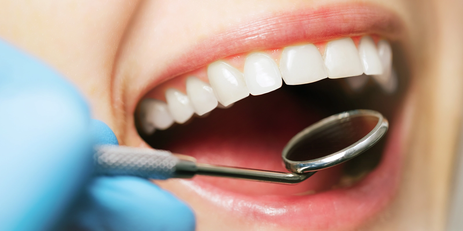 予防歯科の基本的な考え方