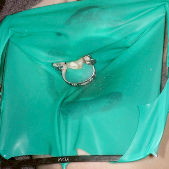 器具の誤飲を防ぐため