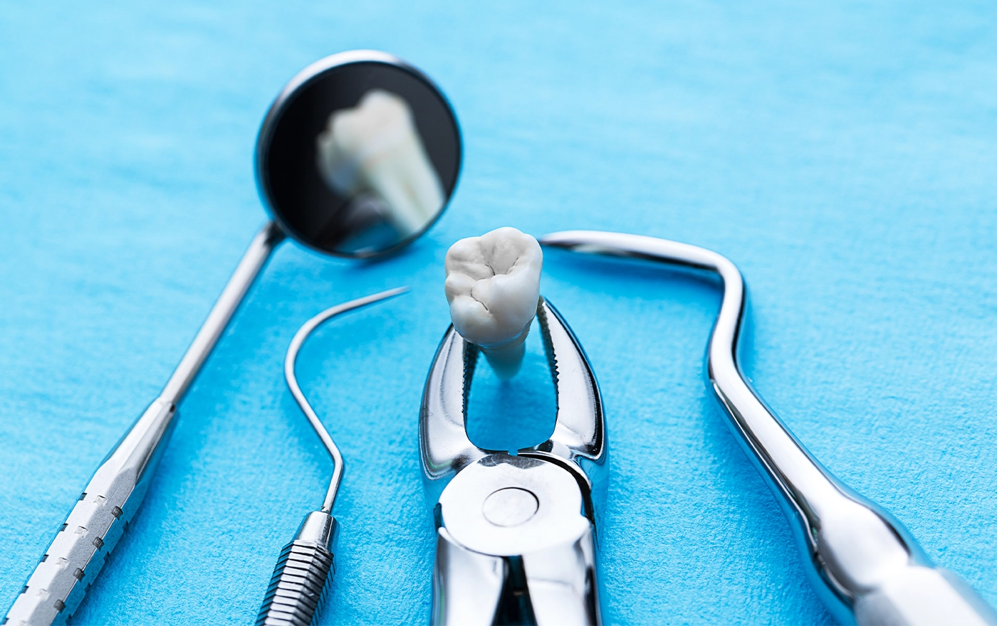 親知らずへの対応